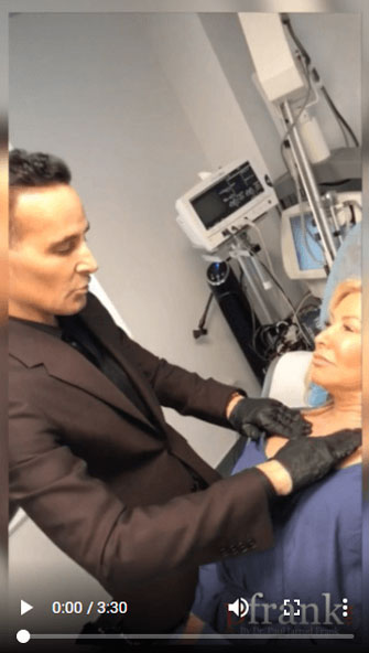 PFRANKMD Threadlifting PFRANKMD Threadlifting