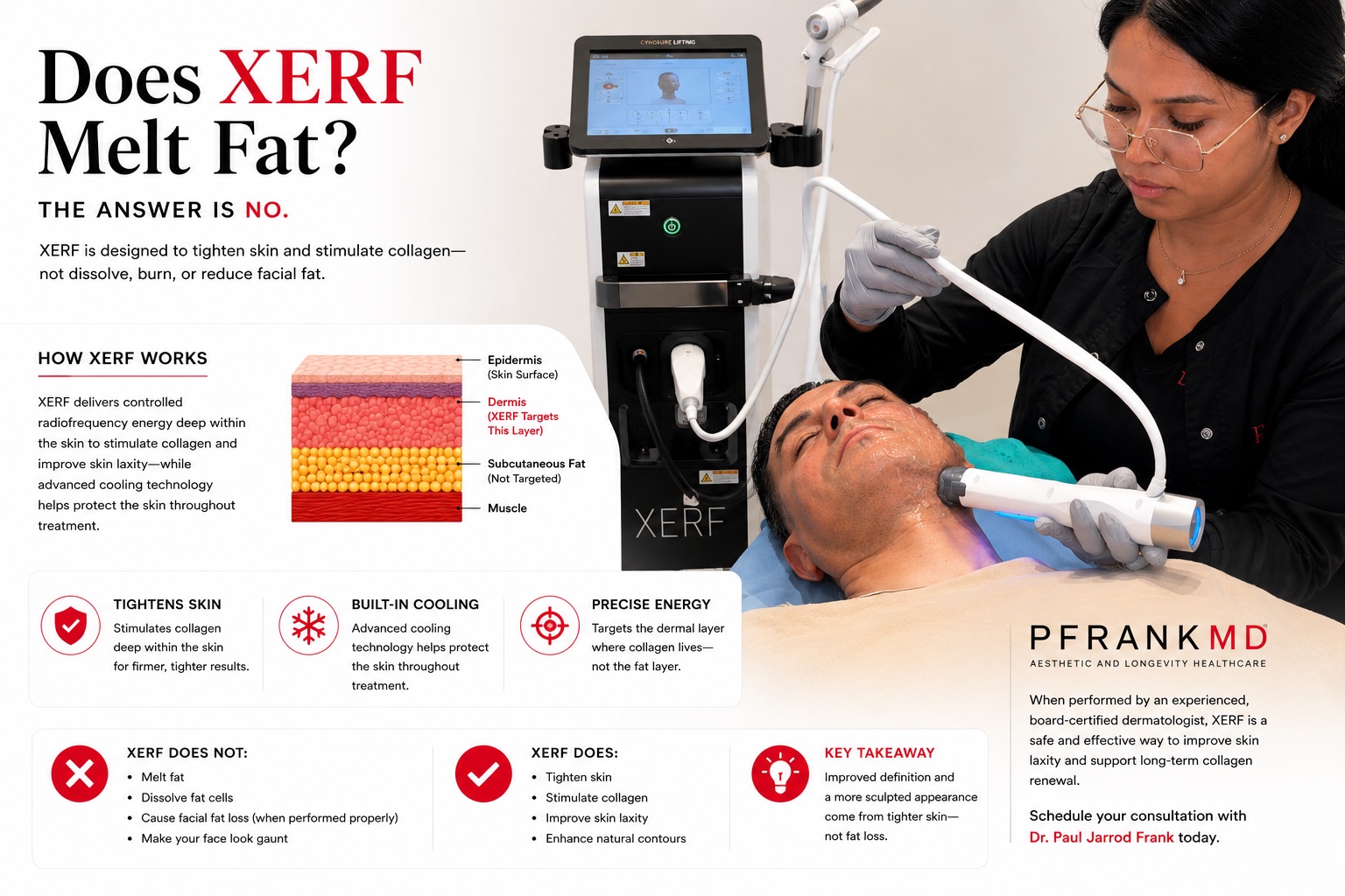 Does XERF Melt Fat? The answer is no. Infographic showing how XERF targets the dermis to tighten skin and stimulate collagen, not the subcutaneous fat layer, alongside a patient receiving XERF treatment at PFRANKMD.